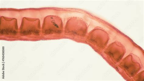  Japonicum: ¡Un parásito trematode que causa estragos en el hígado humano!