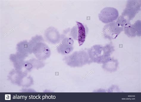  Plasmodium: ¿Un maestro del disfraz que habita en la sangre humana?